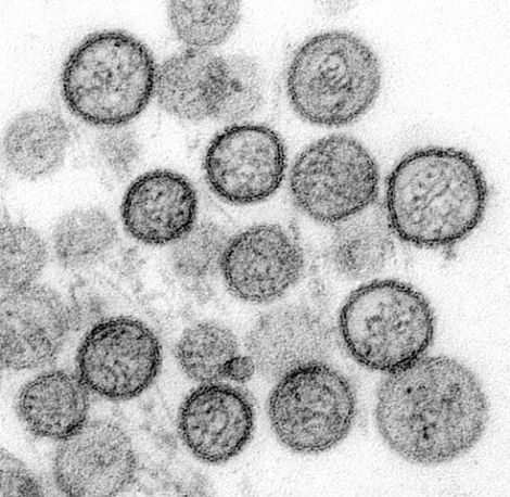 Hantviruses (CDC: Cynthia Goldsmith, Luanne Elliott/Wikimedia Commons)